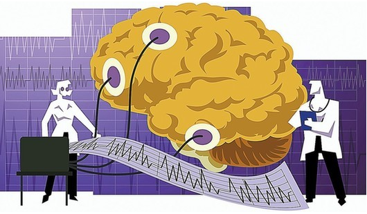 當(dāng)卒中“盯”上中青年 不良生活習(xí)慣埋“禍根”